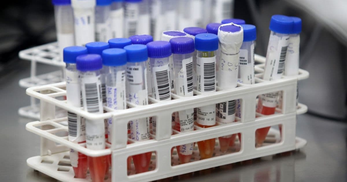 Prefeitura de Salvador compra kits de teste rápido para coronavírus  