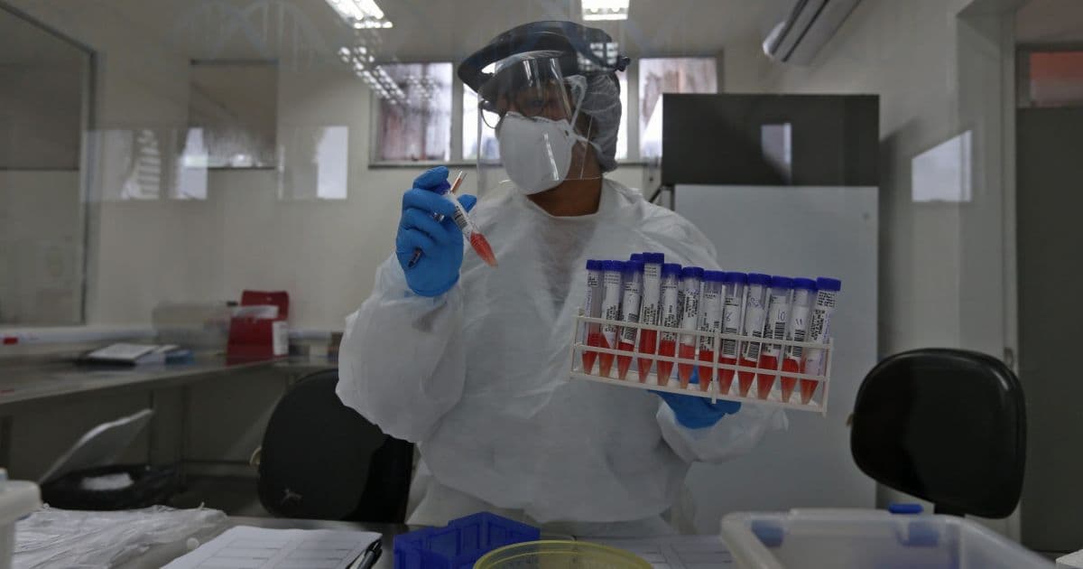 Covid: Brasil tem 53.830 mortes e acumula 1.188.631 infectados desde início da pandemia