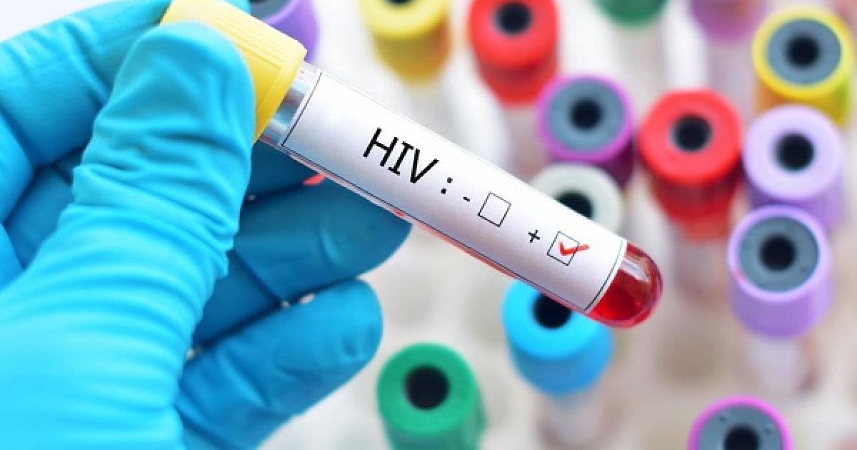 Em SP, centros de pesquisa buscam voluntários para vacina contra HIV