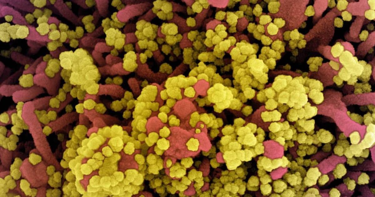 Cientistas descobrem variante do coronavírus em BH; cepa é combinação de 18 mutações