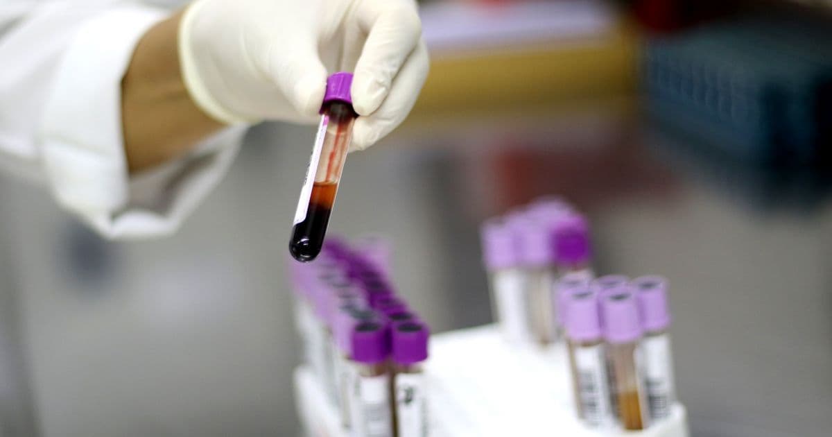 China investigará milhares de amostras de sangue para determinar origem da Covid