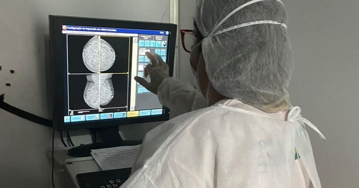 Ação de mamografia em Dias D'Ávila deve beneficiar cerca de 160 mulheres
