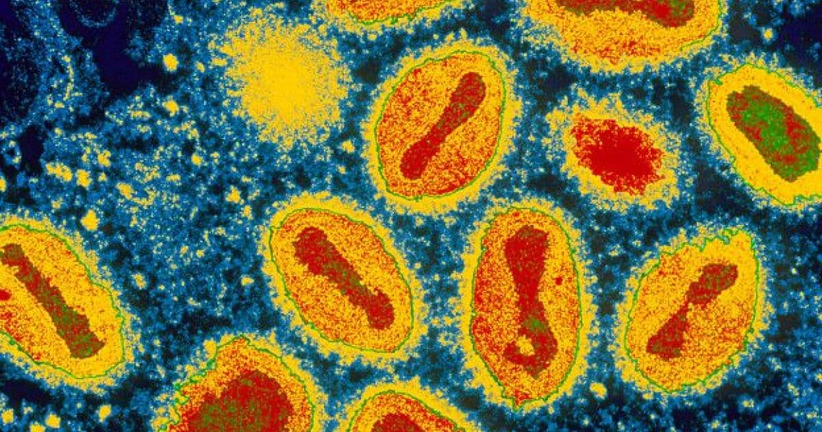 Reino Unido registra mais dois casos de infecção rara de varíola