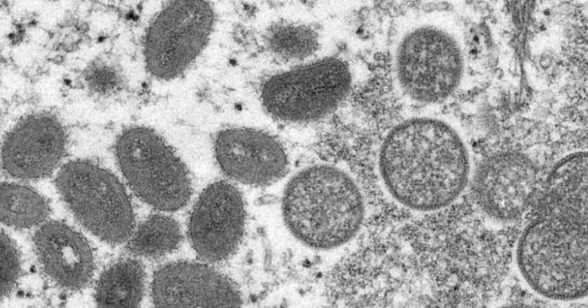 EUA confirma primeiro caso de varíola de macaco no país