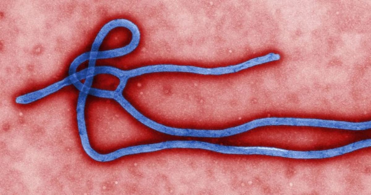 "Primo do Ebola" e um dos vírus mais letais do mundo, Marburg tem surto confirmado pela OMS