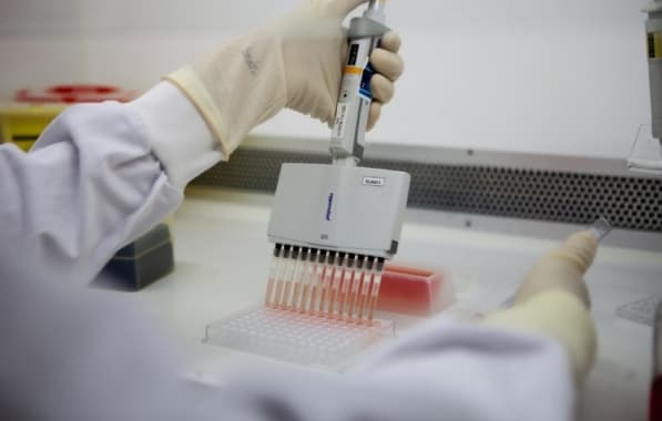 Com auxílio da OMS, Butantan começa a desenvolver vacina contra gripe aviária