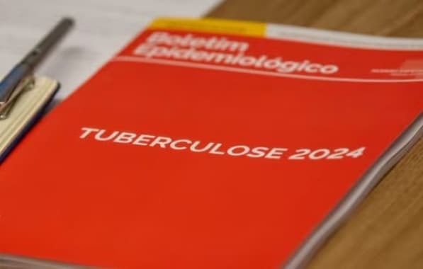 Brasil registra mais de 80 mil novos casos de tuberculose em 2023, aponta boletim epidemiológico