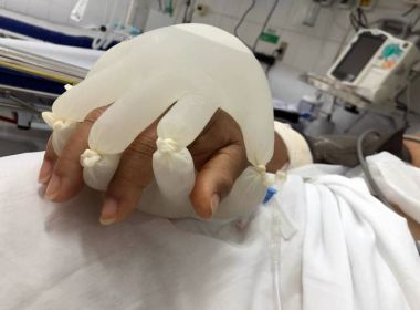 Para amparar intubados com Covid-19, enfermeiros usam 'mãozinha do amor'