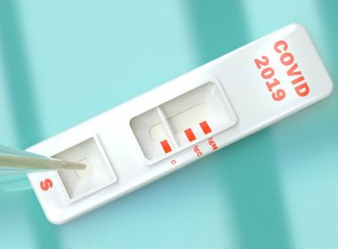 Testes positivos de Covid sobem de 33% para 41% em uma semana, dizem farmácias