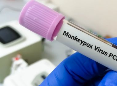 Procura por testes de varíola dos macacos triplica em um mês, diz fabricante