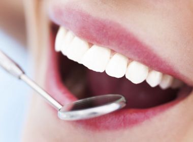 Especialista explica se restaurações dentárias escurecidas devem ser trocadas por brancas