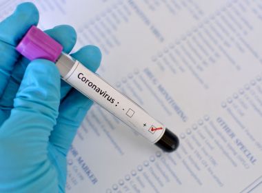 Bélgica é o 10º país com mais de 10.000 casos de coronavírus