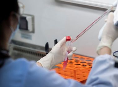 Brasil registra 904 novas mortes por coronavírus; total chega a quase 36 mil