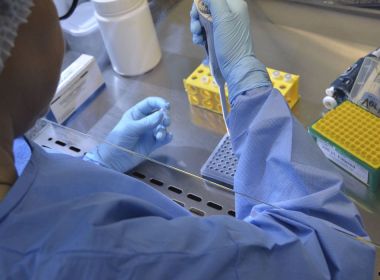 Falta de dados e de transparência criam desconfiança sobre a vacina da Rússia