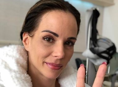 Ana Furtado realiza tratamento para diminuir a queda de cabelo após a quimioterapia 
