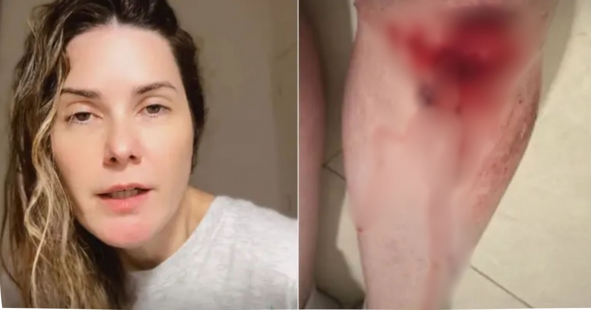 VÍDEO: Apresentadora da Record reage a assalto e fica ferida na Ondina, em Salvador