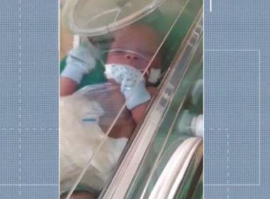 Juazeiro: Bebê com malformação no tórax e abdômen aguarda cirurgia há 17 dias