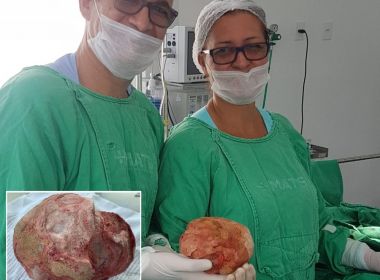 Jacobina: Cirurgia retira pedra de 1,3 kg e 18 cm de bexiga de paciente