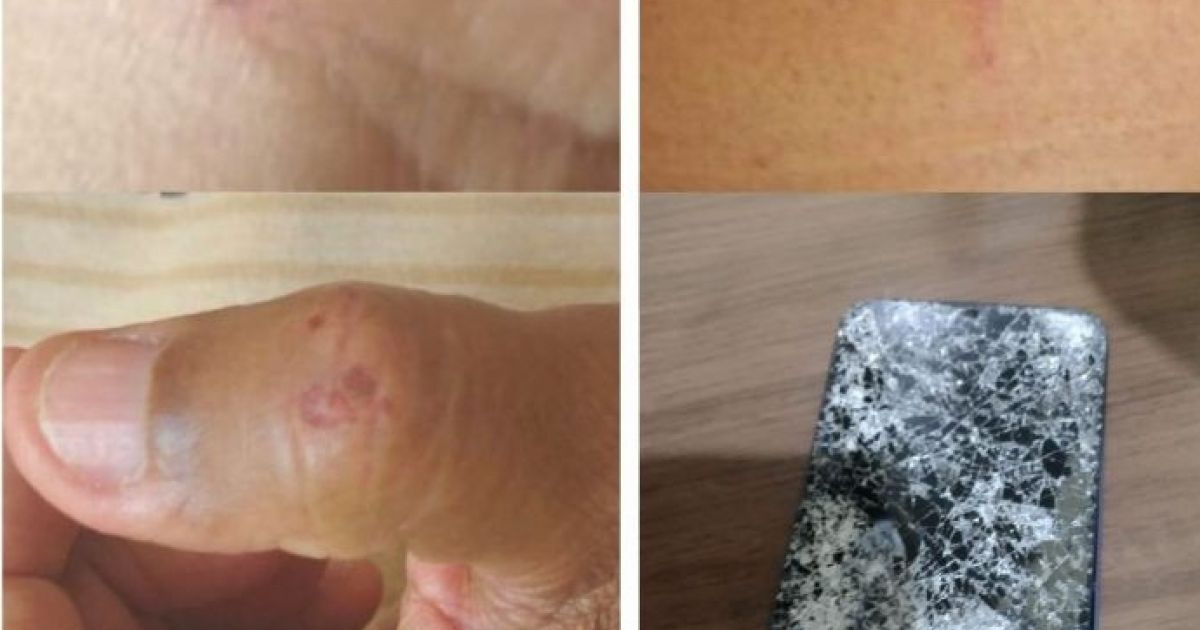 Bahia Notícias / Municípios / Notícia / Cruz das Almas: Jornalista é agredido e tem celular destruído após filmar guerra de espadas - Vimarsana News