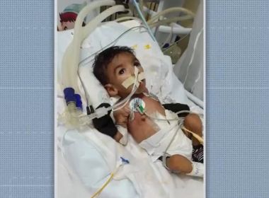 Eunápolis: Família de bebê com doença rara faz 'vaquinha' para custear tratamento