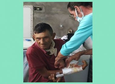 Coité: Idoso atacado por pit bull recebe alta, mas tem dedo polegar amputado