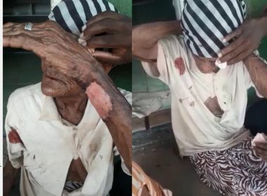 Iaçu: Idosa de 103 anos sofre agressão em assalto
