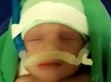 Conquista: Bebê com malformação do cérebro aguarda transferência urgente para UTI