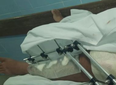 Guanambi: Inquérito apura agressão contra homem com esquizofrenia por parte de PMs