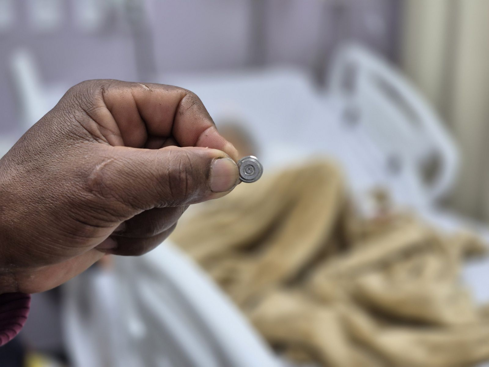 Criança engole peça de brinquedo e passa por cirurgia em Ilhéus