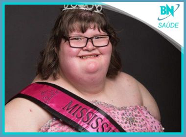 Destaque em Saúde: Menina com síndrome genética rara vence concurso de beleza
