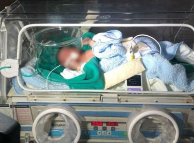 Estado de saúde de índia que foi enterrada viva piora; bisavó vai para Cadeia Pública