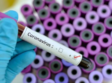  Casos confirmados de coronavírus no Brasil chega a 428 