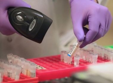 Compra de testes rápidos para coronavírus deve custar até R$ 100 milhões