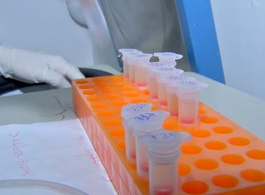 Coronavírus deve infectar 1,1 milhão de baianos até maio, mostra pesquisa