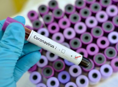 Bahia atinge marca de 100 óbitos por coronavírus; total de casos é 2.676