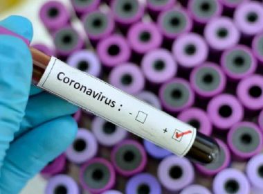 Cresce número de brasileiros que temem ser infectados pelo coronavírus, indica pesquisa