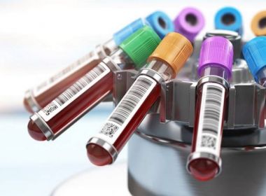 Estudo brasileiro dá início a testes com uso de plasma em pacientes com coronavírus