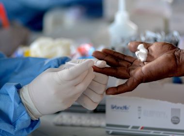 Brasil ultrapassa 125 mil mortes por Covid-19; 888 foram registradas nas últimas 24h