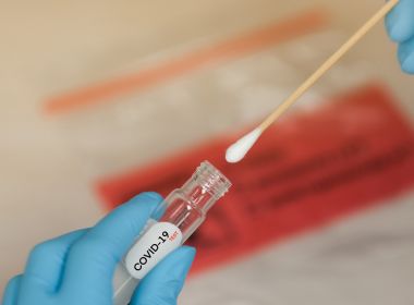 Mundo ultrapassa 80 milhões de infectados pela Covid