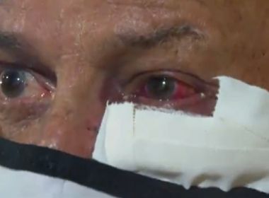 Idoso de 77 anos sofre facada no rosto após reagir a assalto em Salvador