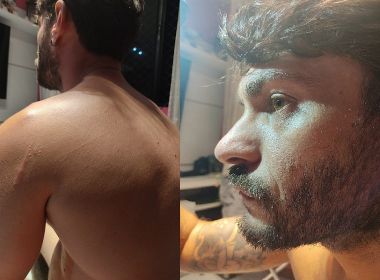 Fotógrafo é agredido e assaltado por grupo em Salvador; equipamento roubado vale R$ 30 mil