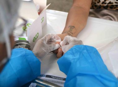 SMS diz seguir protocolo e disponibiliza cerca de 40 testes por dia em cada posto