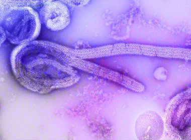 Novo surto de ebola atinge a República Democrática do Congo
