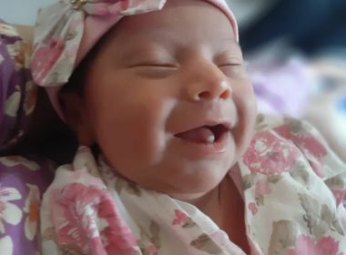 VÍDEO: Bebê nasce com dois dentes no Pará e causa nas redes sociais