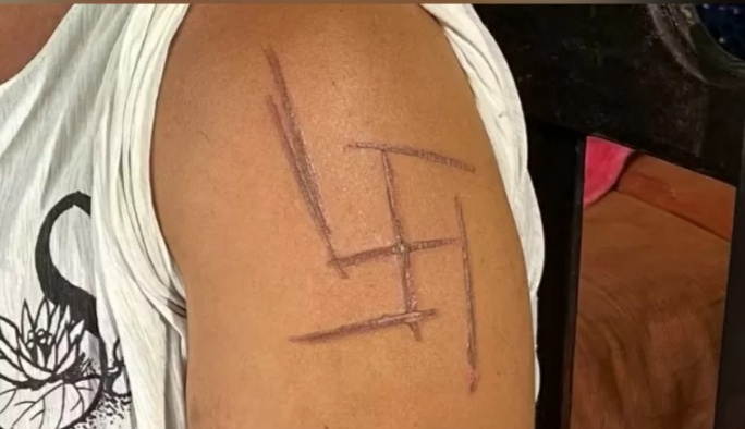 Mulher trans é torturada e marcada com suástica em Mato Grosso do Sul; namorado é suspeito