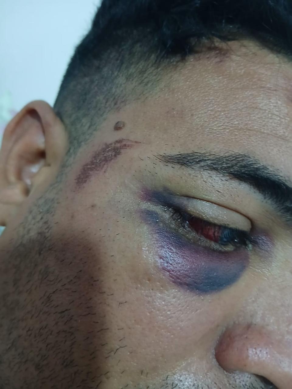 Homem denuncia agressão durante blitz da Lei Seca; caso foi levado à corregedoria da PM