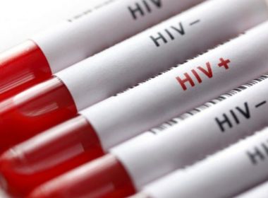 Um em cada 5 homens que fazem sexo com outros homens tem HIV, diz estudo