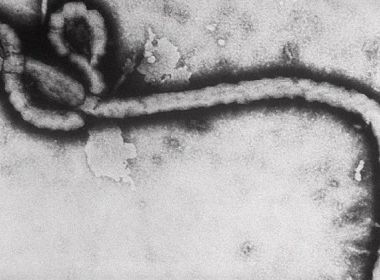 Congo registra mais de 420 casos e 240 mortes por ebola