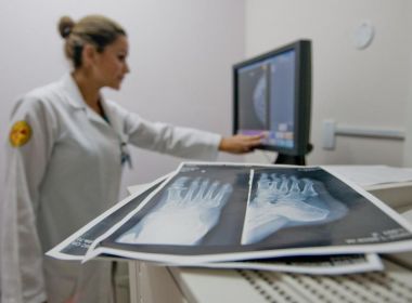 Novos profissionais do Mais Médicos de Salvador serão apresentados na próxima 2ª