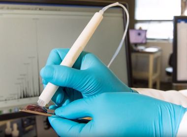 Cientista brasileira cria caneta que detecta câncer durante cirurgia